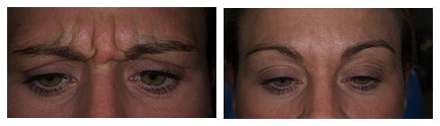 , Smile Gallery: Facial Aesthetics