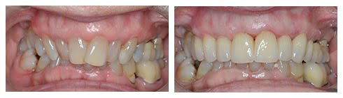 , Smile Gallery: Smile Makeover