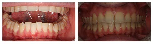 , Smile Gallery: Orthodontics
