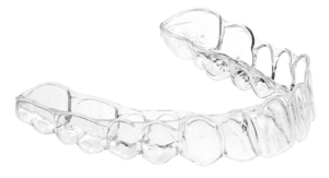 Reveal Aligner Upper Arch